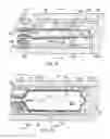 Fig. 12 - Catheter with needles for ablating tissue layers in vessel