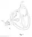 Fig. 02 - CATHETER SYSTEM