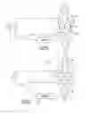 Fig. 07 - Electrosurgical instrument