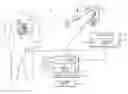 Fig. 01 - Ablation catheter having electronic device disposed within a lumen