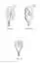 Fig. 13 - Methods and apparatuses for remodeling tissue of or adjacent to a body passage
