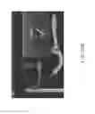Fig. 34 - Methods and apparatuses for remodeling tissue of or adjacent to a body passage