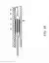 Fig. 47 - Methods and apparatuses for remodeling tissue of or adjacent to a body passage