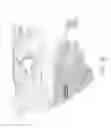 Fig. 50 - Methods and apparatuses for remodeling tissue of or adjacent to a body passage