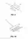 Fig. 08 - DEVICES FOR TISSUE SEPARATION AND RELATED METHODS OF USE