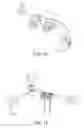 Fig. 07 - External fixation