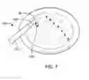Fig. 07 - Surgical device