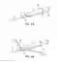 Fig. 07 - Methods and devices for removing a spinal disc