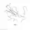 Fig. 02 - Decorticating surgical instruments and guidance systems with tactile feedback