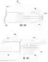 Fig. 35 - Tools and methods for tissue removal
