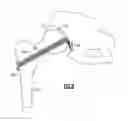 Fig. 07 - Drill guide assembly