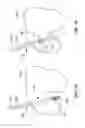 Fig. 40 - Retro guidewire reamer