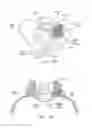 Fig. 08 - SYSTEMS AND METHODS FOR IMPLANTING BONE GRAFT AND IMPLANT