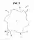 Fig. 07 - MODULAR TAPERED REAMER FOR BONE PREPARATION AND ASSOCIATED METHOD