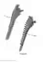 Fig. 09 - Bone broach and method of manufacturing a bone broach