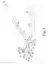 Fig. 03 - Instruments for use in the implantation of an ankle prosthesis and method of using the same