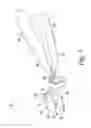 Fig. 04 - Instruments for use in the implantation of an ankle prosthesis and method of using the same