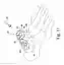 Fig. 15 - Instruments for use in the implantation of an ankle prosthesis and method of using the same