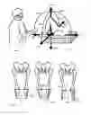 Fig. 02 - Bone cutting system for the leg and method therefor