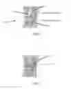 Fig. 02 - Systems and methods for providing alignment in total knee arthroplasty
