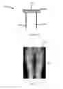 Fig. 09 - Systems and methods for providing alignment in total knee arthroplasty
