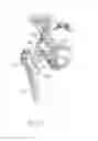Fig. 02 - Patient-specific assemblies, jigs, and methods for a personalized total hip arthroplasty system