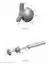 Fig. 09 - Patient-specific assemblies, jigs, and methods for a personalized total hip arthroplasty system