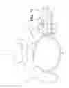 Fig. 09 - Surgical probe incorporating a dilator