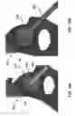 Fig. 35 - CUSTOMIZED ACETABULAR CUP POSITIONING GUIDE AND SYSTEM AND METHOD OF GENERATING AND EMPLOYING SUCH A GUIDE