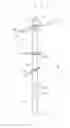 Fig. 01 - Device for performing a surgical procedure and method