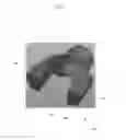 Fig. 07 - Void filling joint prosthesis and associated instruments