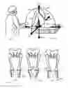 Fig. 02 - System and method for measuring muscular-skeletal alignment to a mechanical axis