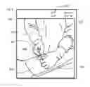Fig. 06 - System and method for measuring muscular-skeletal alignment to a mechanical axis