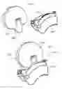 Fig. 22 - System for surgical information and feedback display