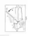 Fig. 09 - PORTABLE SURGICAL GUIDE WITH LASER, ABDUCTION AND ANTEVERSION MEASURING SYSTEM AND METHOD OF USING SAME