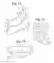 Fig. 07 - TOWER TOOL FOR MINIMALLY INVASIVE SURGERY