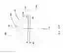 Fig. 06 - Laproscopic instrument depth stop