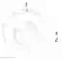 Fig. 07 - Laproscopic instrument depth stop