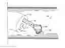 Fig. 01 - Resection device with support mechanism and related methods of use
