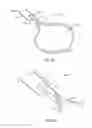 Fig. 02 - Tissue resection snares