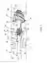 Fig. 06 - Shape memory metal emboli trap
