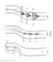 Fig. 07 - Shape memory metal emboli trap