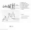 Fig. 20 - Trocar cannula assembly with low profile insertion configuration and method of manufacture