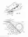Fig. 28 - Catheter system with magnetic coupling