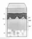 Fig. 01 - SOFT TISSUE REPAIR ALLOGRAFTS AND METHODS FOR PREPARING SAME