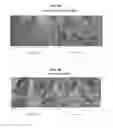 Fig. 08 - SOFT TISSUE REPAIR ALLOGRAFTS AND METHODS FOR PREPARING SAME