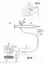 Fig. 03 - System and method for determining the position of a hair tail on a body surface
