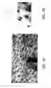 Fig. 04 - System and method for determining the position of a hair tail on a body surface