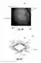 Fig. 05 - Locator device for medical procedures on the body surface and method of its use