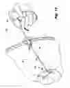 Fig. 07 - Flex cable and spring-loaded tube for tacking device